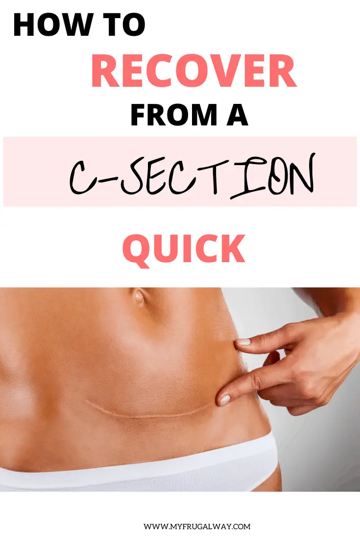 how to recover from a section quickly. Best c section recovery tips to help you heal faster. Things I wish I knew before my c section surgery.