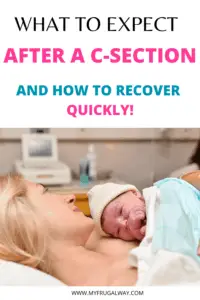 How To Recover From A C-Section - MyFrugalWay